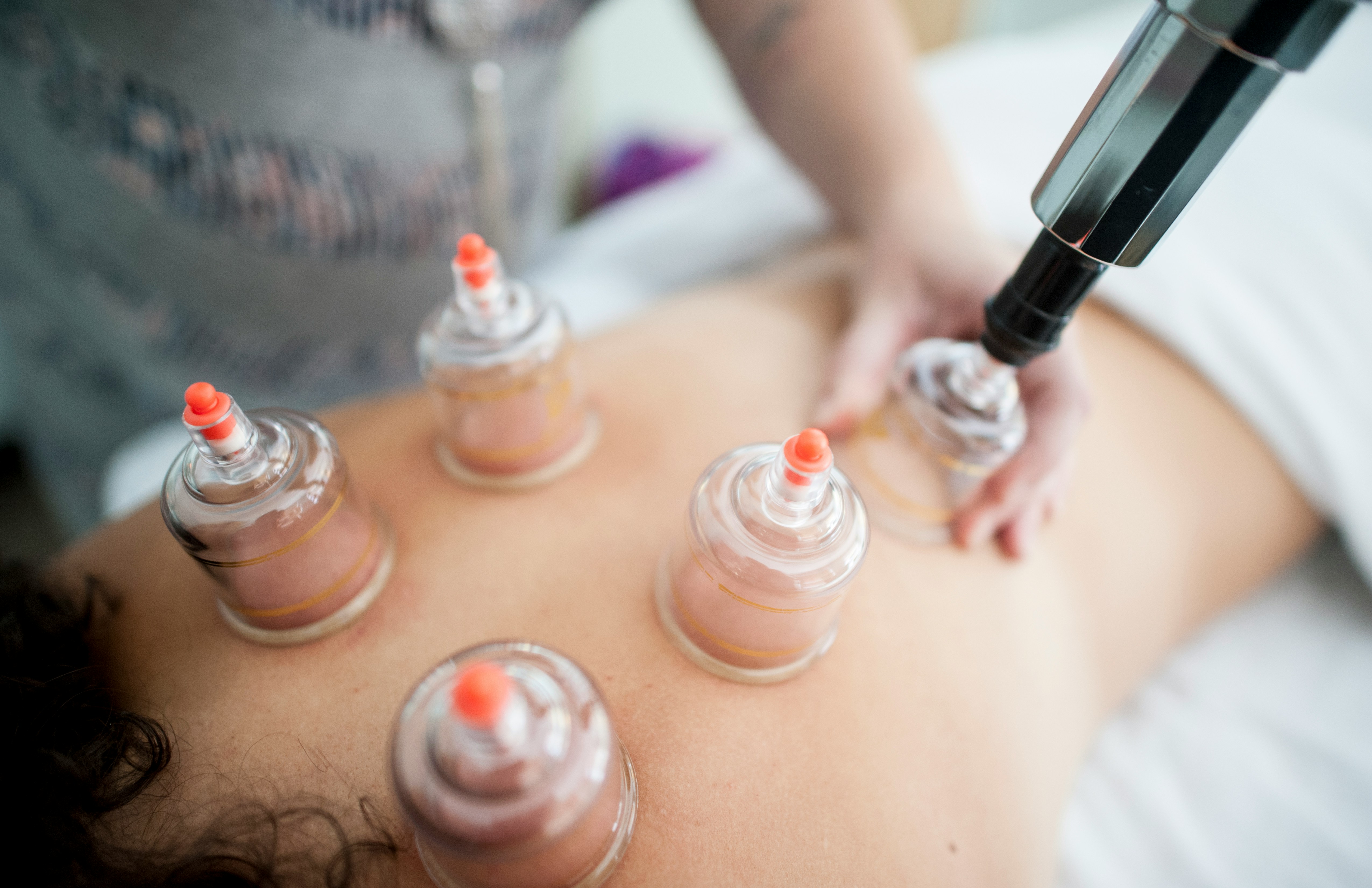 Massagem com ventosas terapêuticas